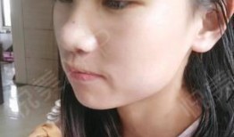 小丽爆料医美视频,医美行业幕后真相，视频曝光惊人内幕